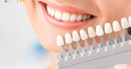 Bọc răng sứ là giải pháp - Không phải trào lưu