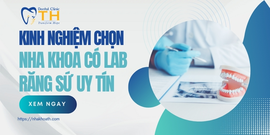 kinh nghiem chon labo rang su uy tin tai tp hcm