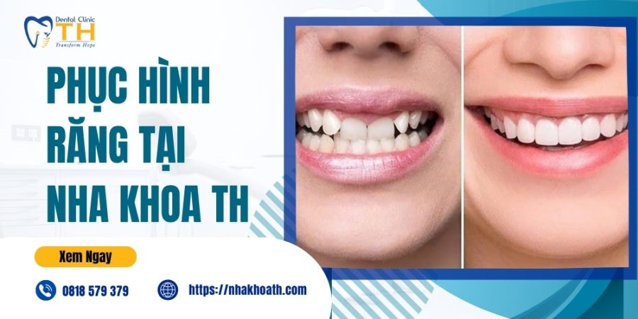 Phuc Hinh Rang Tai Nha Khoa TH
