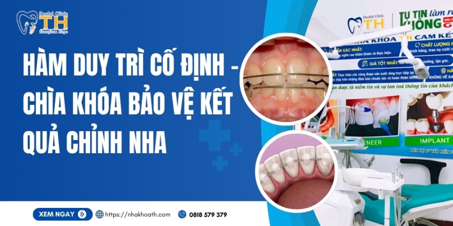 ham-duy-tri-co-dinh-chia-khoa-bao-ve-ket-qua-chinh-nha