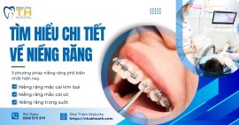 nieng-rang-la-gi-quy-trinh-va-loi-ich-khi-nieng-rang-ban-nen-biet
