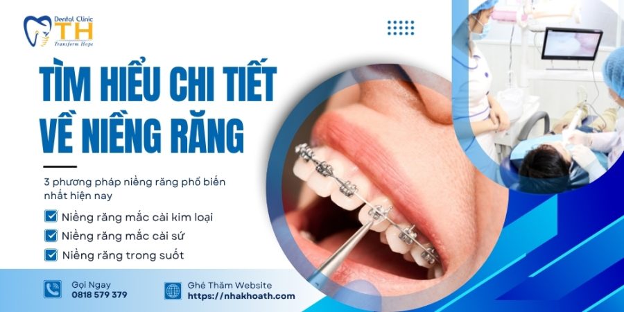 nieng-rang-la-gi-quy-trinh-va-loi-ich-khi-nieng-rang-ban-nen-biet